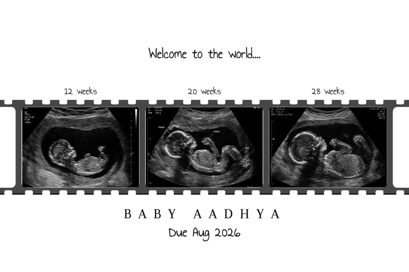 WELCOME TO THE WORLD FRAME